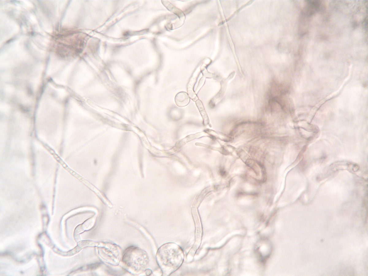 Pilz überlebt Medikamente durch Kopien seines Genoms, zeigt Studie