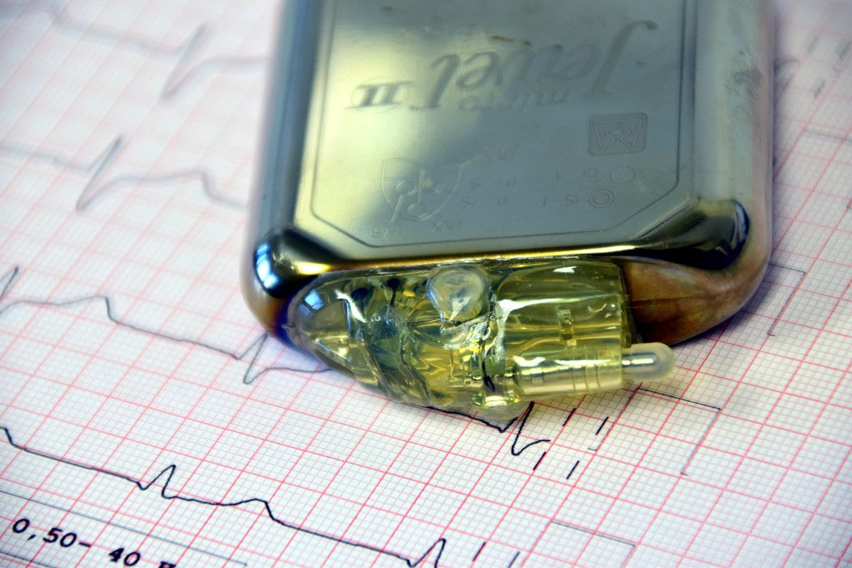 Schweizer Forscher entwickeln Implantat, das Blutzucker per Strom in Säure umwandelt